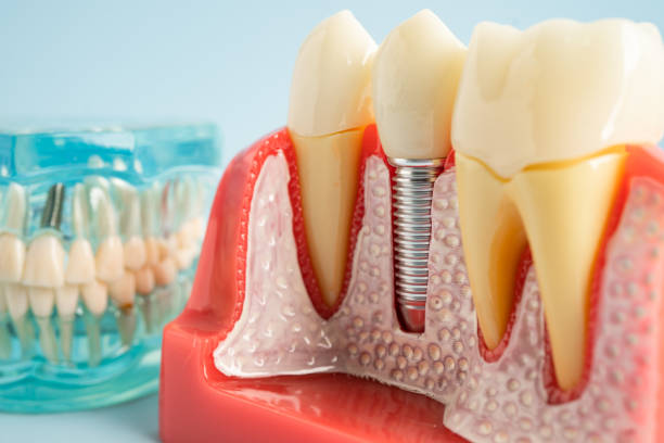 Best General Dentistry  in Brentwood, NY